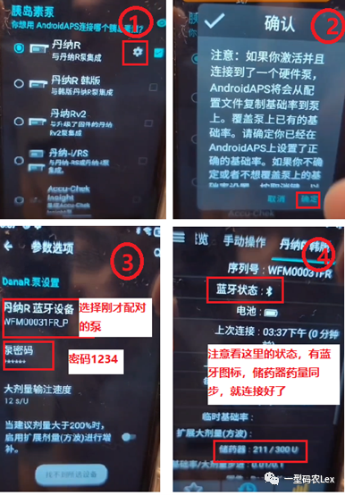 AndroidAPS中丹纳R泵配置入口